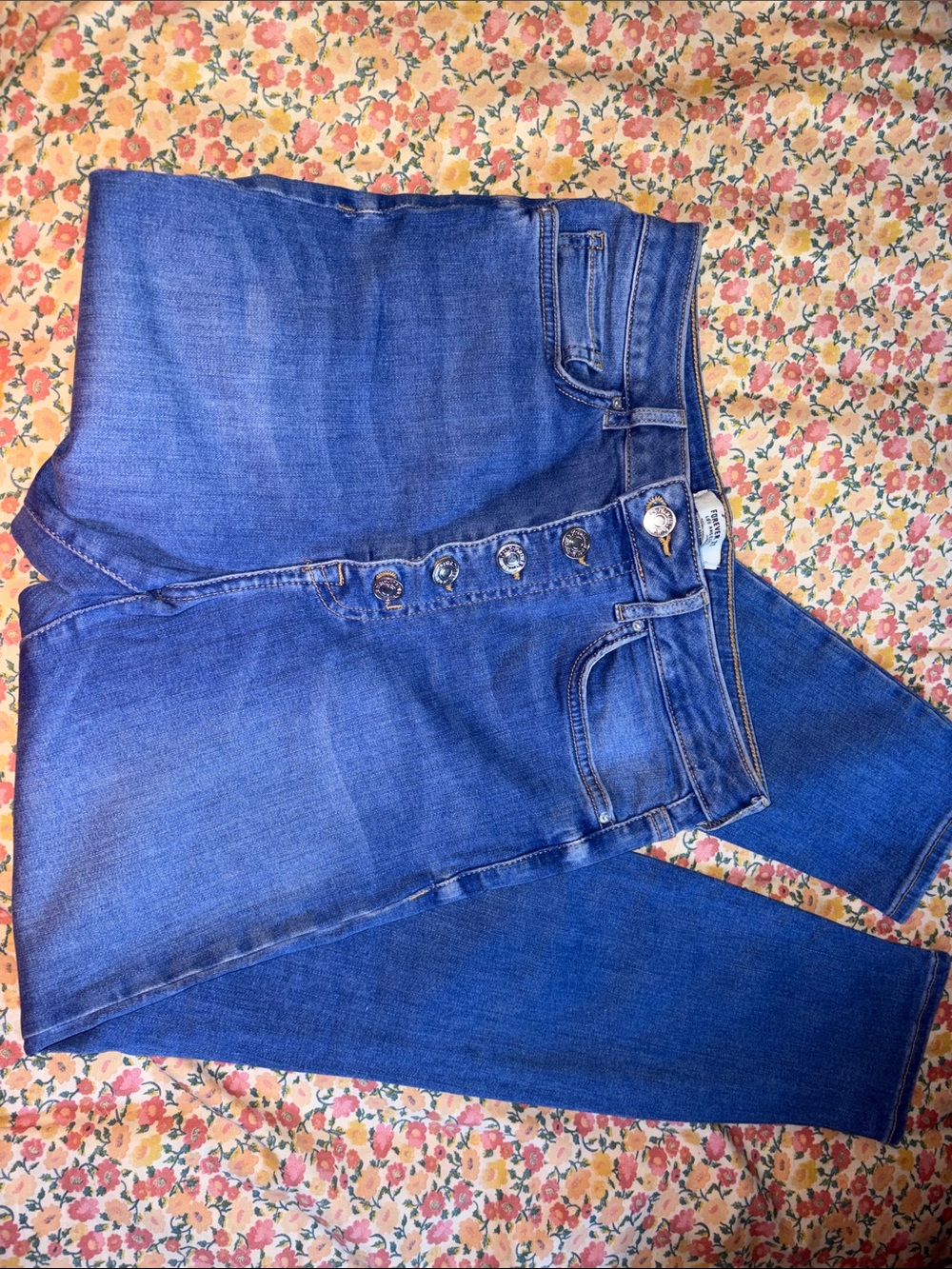 Madewell High-Rise Button-Fly Blue Jeans